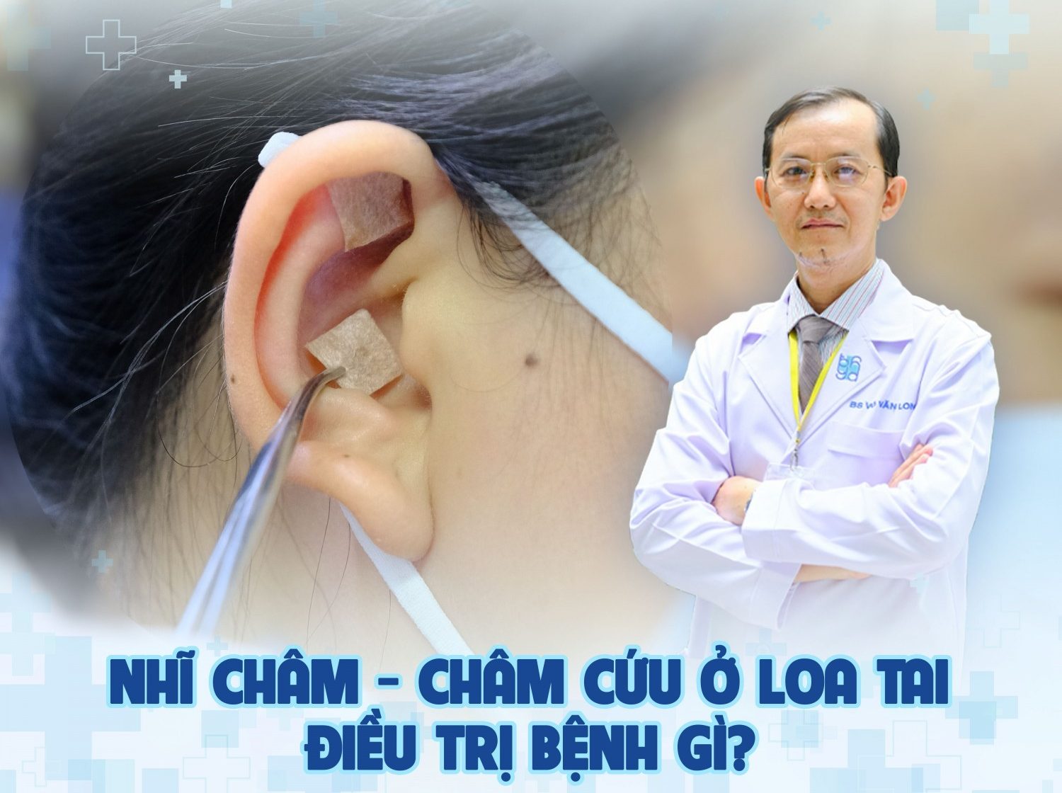 Nhĩ châm – Châm cứu ở loa tai có tác dụng gì?