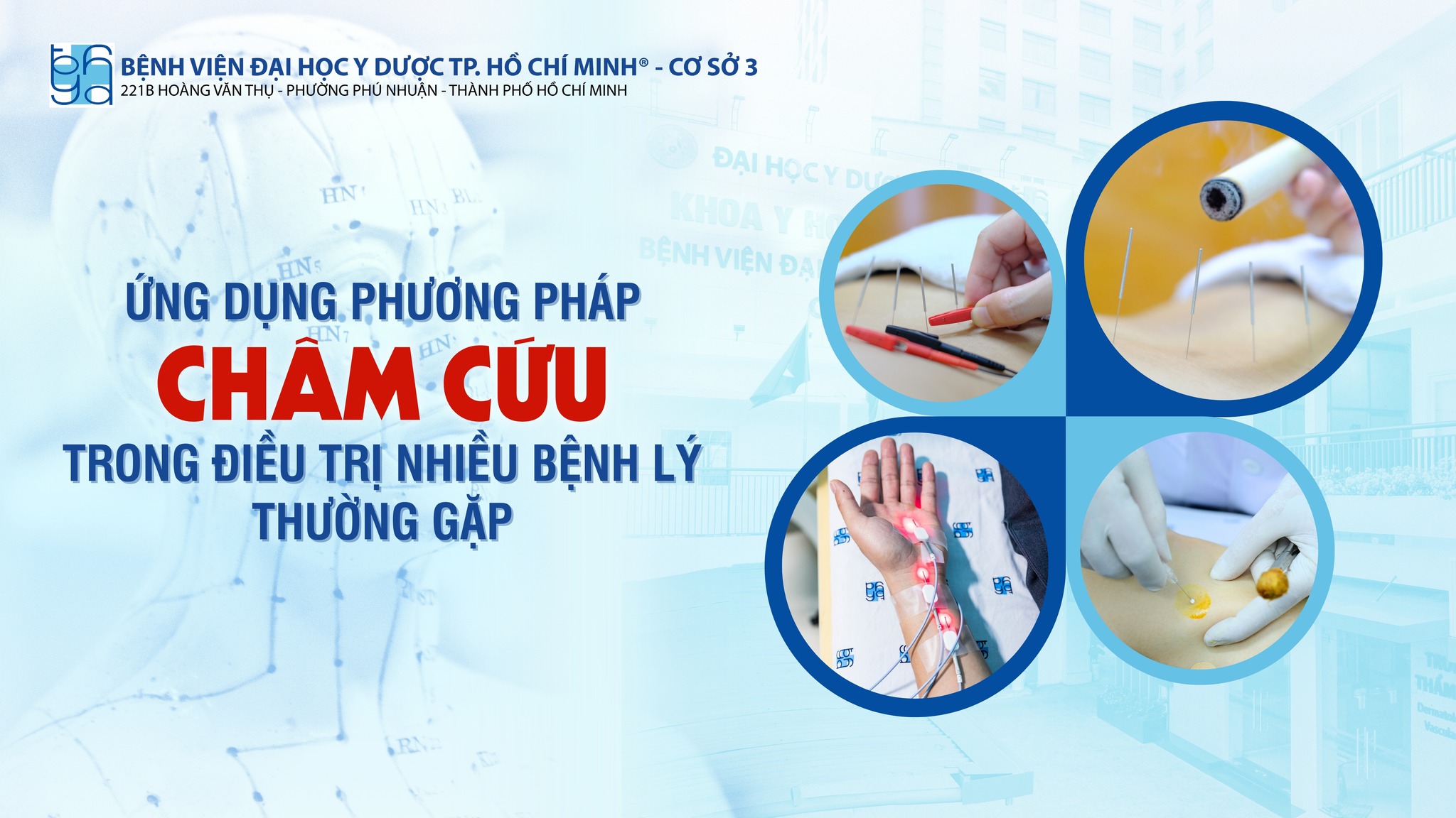 Ứng dụng phương pháp châm cứu trong điều trị các bệnh lý thường gặp